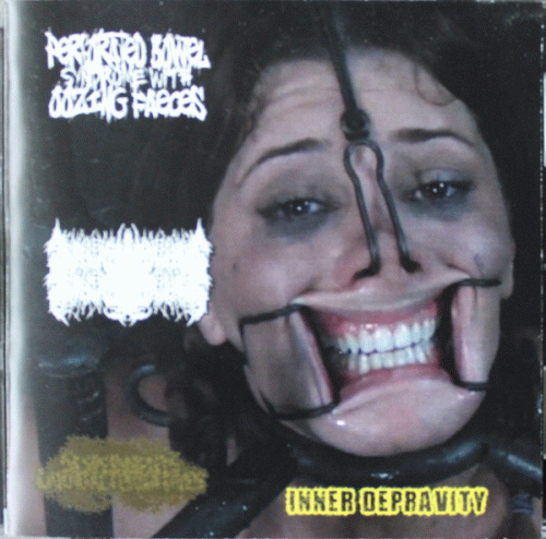 Perforated Bowel Syndrome With Oozing Faeces : Inner Depravity